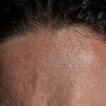 Cosa succede davvero alla tua cute se smetti di lavare i capelli con lo shampoo tradizionale