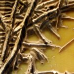 Fibromatosi superficiali: quando il corpo produce tessuto cicatriziale dove non dovrebbe