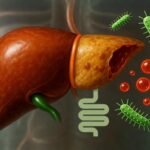 La malattia del fegato poco conosciuta: Mash