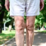 Perché le Ginocchia Fanno Male Dopo i 55 e Come Aiutarle