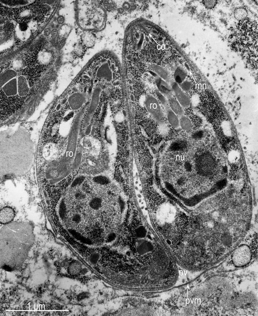 Phylum Apicomplexa Toxoplasma