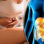 come prevenire il morbo di crohn
