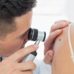 melanoma delle pelle primi segnali da conoscere