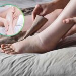 rimedi naturali per piedi gonfi