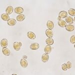 Il fungo che resiste ai farmaci: perché Candida auris preoccupa gli esperti