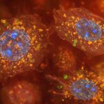 Patologia dell’invecchiamento cellulare accelerato dal calore