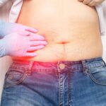 Calcoli biliari: perché possono provocare dolore dopo i pasti