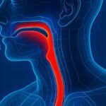 Disfagia: quando deglutire diventa difficile