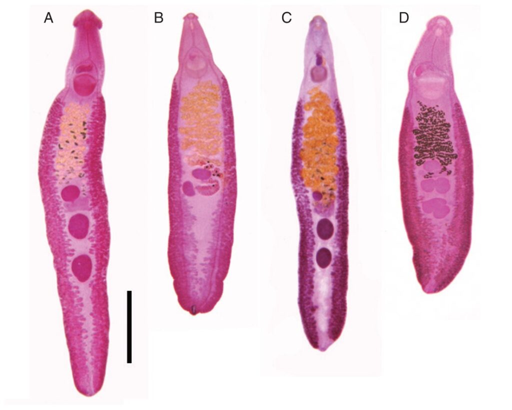 Echinostoma