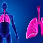 Sarcoidosi: la malattia che può coinvolgere polmoni e altri organi