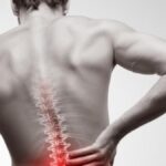 Spondilite anchilosante di cosa si tratta e come curarla