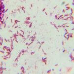 Batteri a forma di bastoncino: cosa sono i bacilli