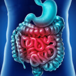 Duplicazione intestinale: la rara anomalia congenita che può interessare il tubo digerente