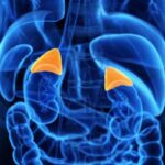 Iperplasia surrenalica congenita: la malattia genetica che altera la produzione ormonale