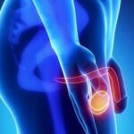 Ipogonadismo: cosa succede quando le gonadi producono pochi ormoni sessuali