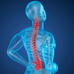 Mielite: cosa succede quando si infiamma il midollo spinale