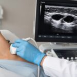 Noduli alla tiroide: quando preoccuparsi