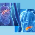 Pancreas divisum: la variante anatomica che riguarda i dotti pancreatici